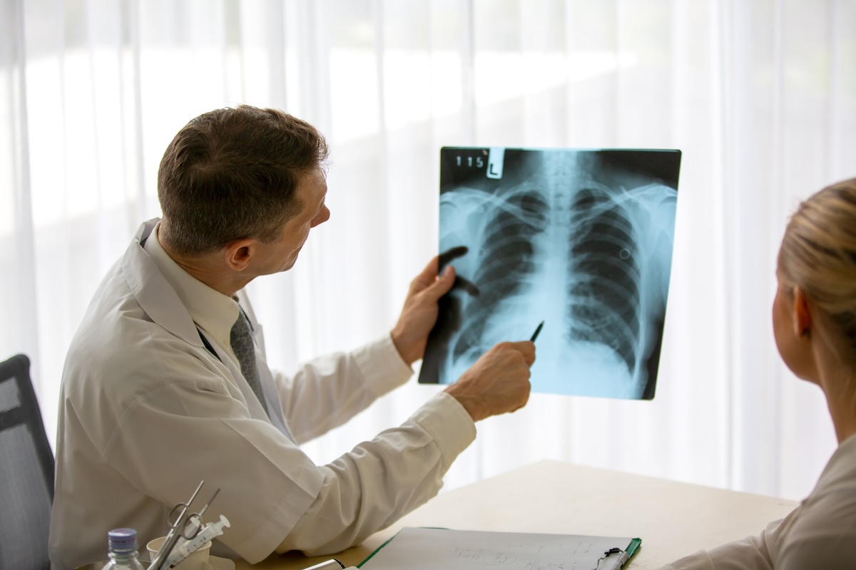 Pulmonologist reviewing chest X-rays